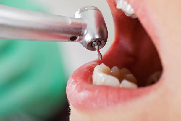 Best Emergency Dental Care for Sports Injuries in Beechwood, MI